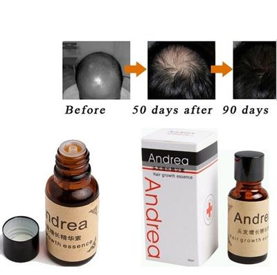 Andrea hair treatment Hair Growth Essence Hair Loss Liquid 20ml