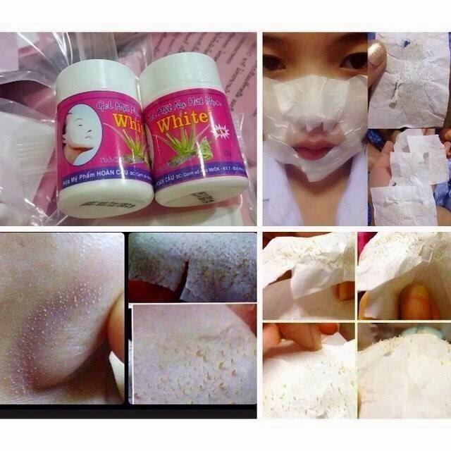 Blackhead and Whitehead Removal Vietnam Mask Blackhead and Whitehead Removal Vietnam Mask