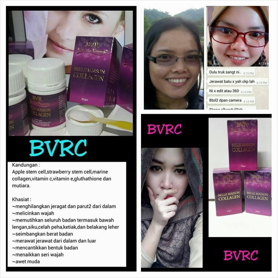 bvr collagen bvrc end 9 30 2016 9 05 am myt bvr collagen bvrc end 9 30 2016 9 05 am myt