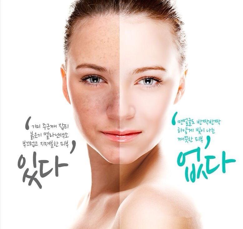 cloud 9tm korea lotte skin lightening kuala lumpur end time 7 27 2015 3 01 00 pm myt cloud 9tm korea lotte skin lightening kuala lumpur end time 7 27 2015 3 01 00 pm myt