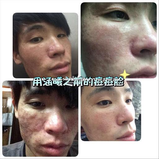 Image result for Latoja hyaluronic acid serum