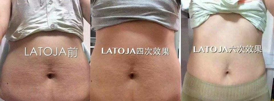 Latoja Slimming Cream Latoja Slimming Cream