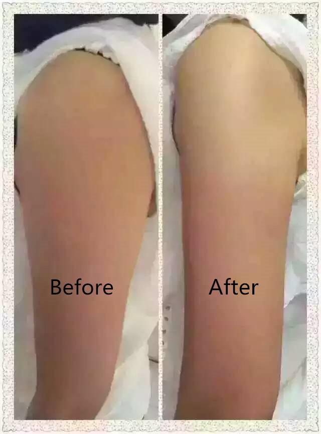 Latoja Slimming Cream Latoja Slimming Cream