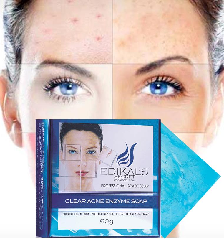 Clear Acne Enzyme Soap by Edikal's Secret with Free Extra Acne Mask Clear Acne Enzyme Soap by Edikal's Secret with Free Extra Acne Mask