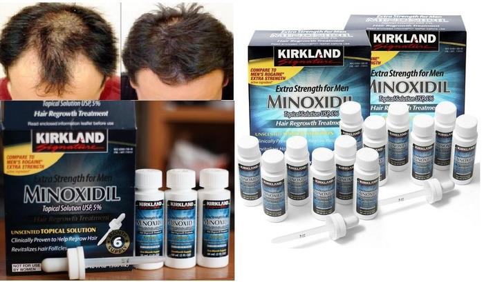 Kirkland Minoxidil 5% Extra Strength Hair Regrowth for Men,에 대한 이미지 검색결과
